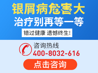 南京華廈銀屑病專病門診